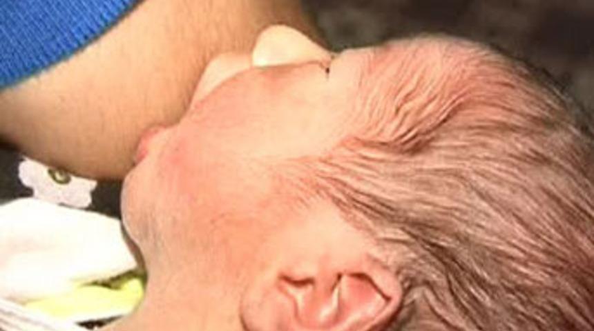 Bir g&uuml;nl&uuml;k, a&ccedil;lıktan kol emiyor