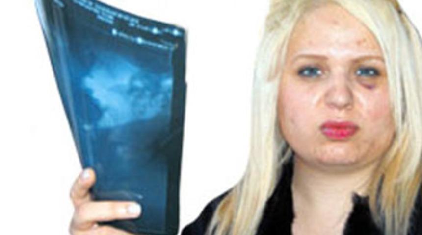 Yoğun bakımda toplu dayak isyanı