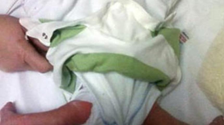 Bacakları ters doğdu