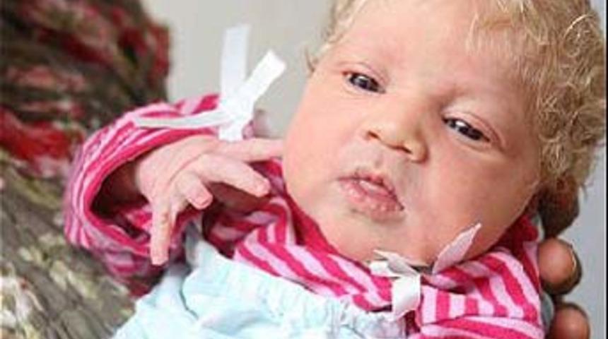 Tıp d&uuml;nyası şokta!