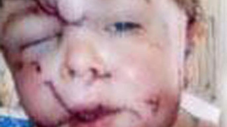 K&ouml;pek, &ccedil;ocuğun y&uuml;z&uuml;n&uuml; par&ccedil;aladı