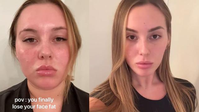 'Kilo verdikten sonra tanınmaz hale geldiğimi söylüyorlar' Görenler şaşkına döndü 'Aynı kişi olduğuna inanmayı reddediyorum'