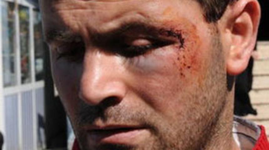 Hastanede g&uuml;venlik&ccedil;i ter&ouml;r&uuml;