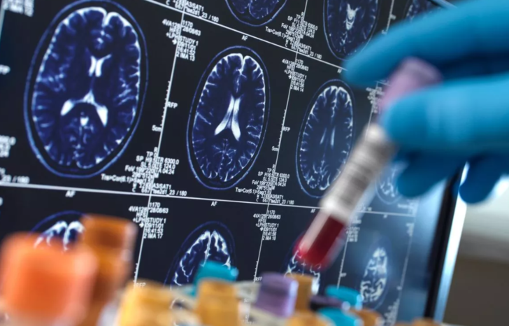 Elinizi burnunuza götürürken bir kez daha düşünün! Meğer tehlikeli hastalık parmaklardan beyne geçiyormuş G1