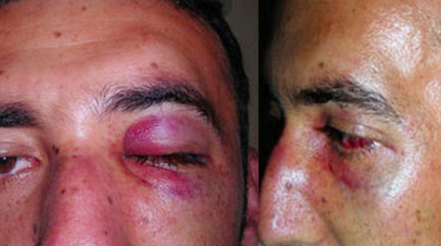 Polise kimlik sordu dayak yedi