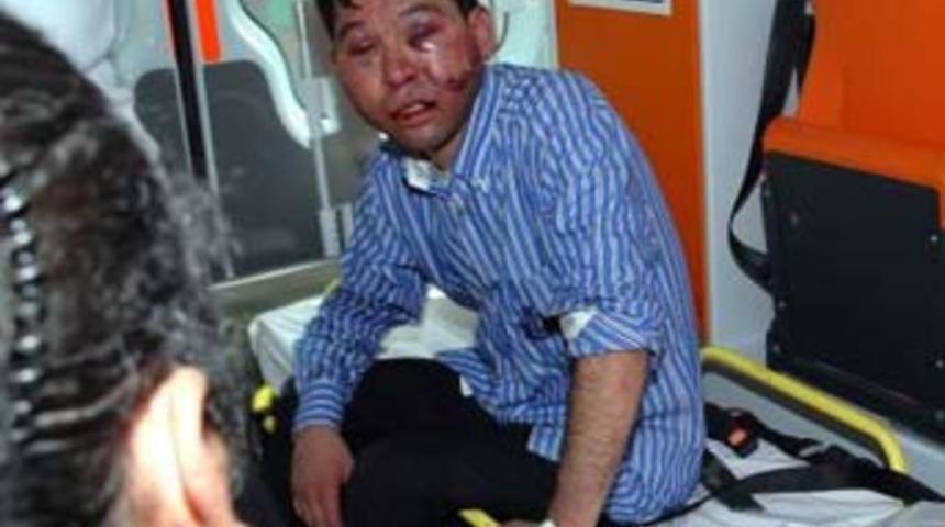 100 bin liram var deyince...