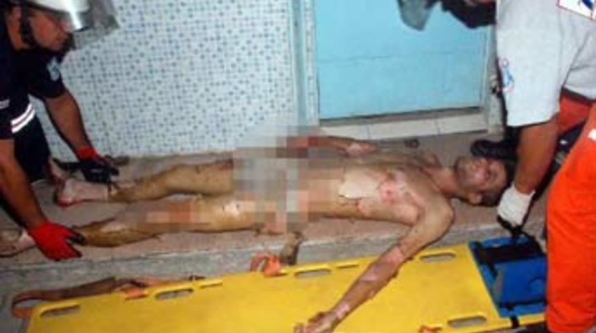 Sıkışan gaz patladı: 1 ağır yaralı