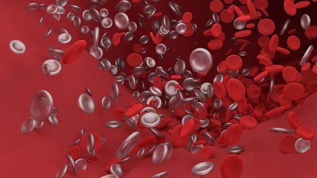 Profesör açıkladı Toplardamar pıhtılarında kritik süre ilk 15 gün