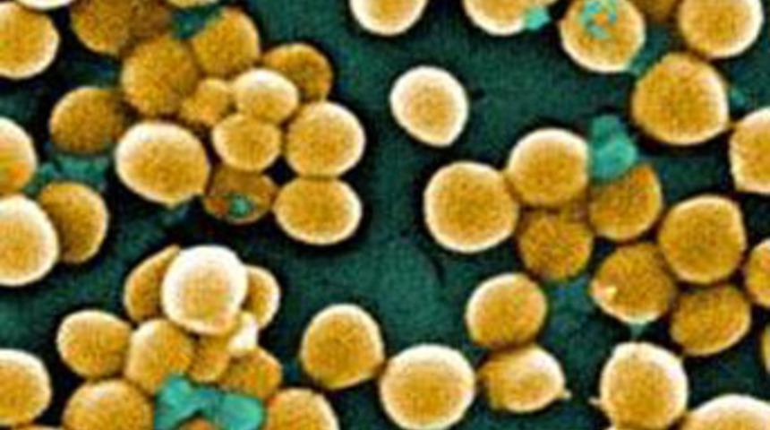 Hastaların kurtuluşu bu boyada