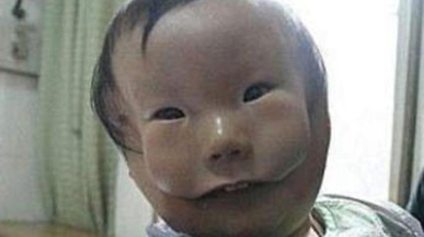 Tıp d&uuml;nyasını hayrete d&uuml;ş&uuml;ren olay!