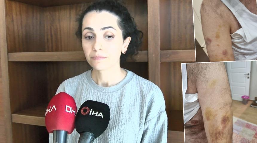 Otizmli öğrenciye öğretmeninden dayak iddiası! "Sopayla dövdü, boğazımı sıktı, bacağıma vurdu"