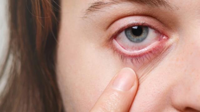 Kışın artan bu salgına dikkat! Belirtiler bir anda başlıyor... 'Görme kaybına neden olabiliyor' diyerek uyardı 