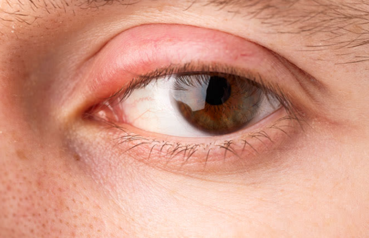 Kışın artan bu salgına dikkat! Belirtiler bir anda başlıyor... 'Görme kaybına neden olabiliyor' diyerek uyardı  G2