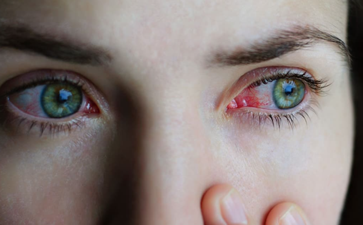 Kışın artan bu salgına dikkat! Belirtiler bir anda başlıyor... 'Görme kaybına neden olabiliyor' diyerek uyardı  G1