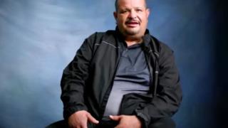 İki penisle dünyaya gelen adamın cinsellik itirafları çok konuşuldu! Son derece nadir görülüyor: Kadınlar bana bağımlı