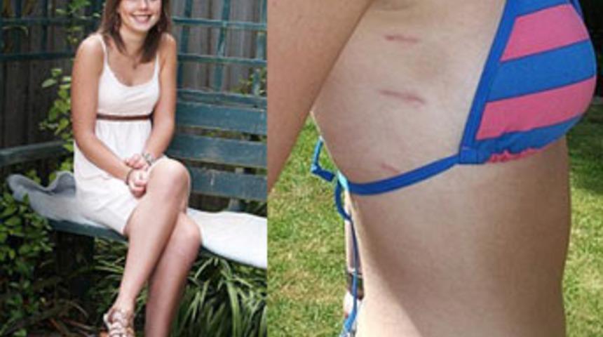 G&uuml;lme yeteneğini aniden kaybetti