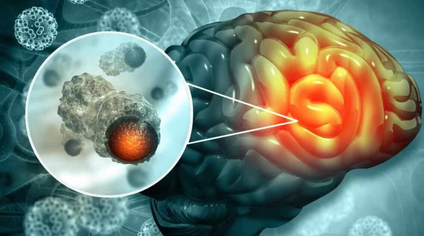 Herkes yapıyor ama zararını kimse bilmiyor! Beyine zarar veren 3 alışkanlık