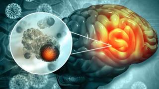 Herkes yapıyor ama zararını kimse bilmiyor! Beyine zarar veren 3 alışkanlık