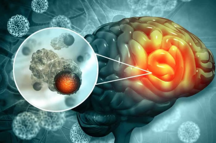 En çok erkeklerde görülüyor! "Tümü öldürücü olmasa da, mutlaka kontrol altında tutulmalı" Bu belirtiler varsa hemen doktora başvurun G2