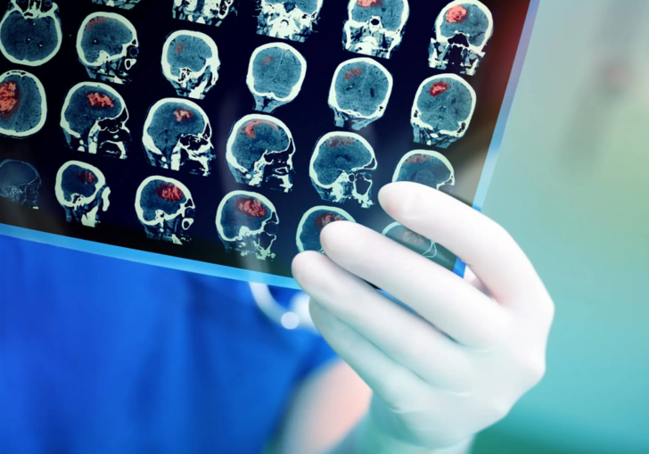 En çok erkeklerde görülüyor! "Tümü öldürücü olmasa da, mutlaka kontrol altında tutulmalı" Bu belirtiler varsa hemen doktora başvurun G3