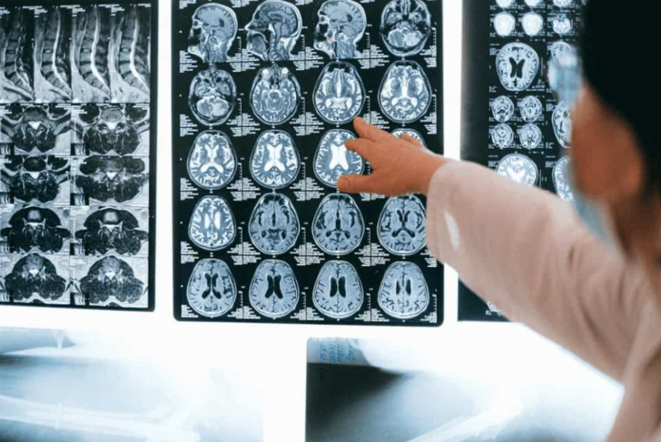 En çok erkeklerde görülüyor! "Tümü öldürücü olmasa da, mutlaka kontrol altında tutulmalı" Bu belirtiler varsa hemen doktora başvurun G5