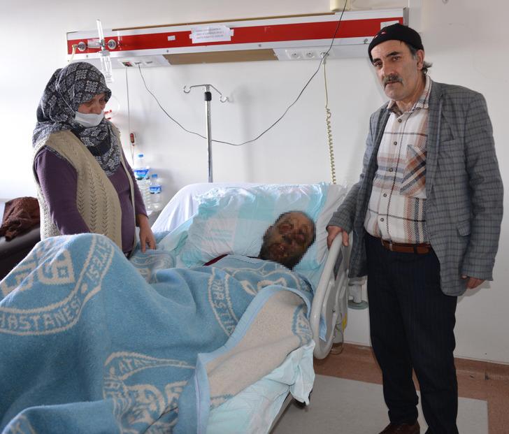 Pemfigus hastalığı 1 yılda yüzünü tanınmaz hale getirdi! 'Aynaya bakamıyorum' G1