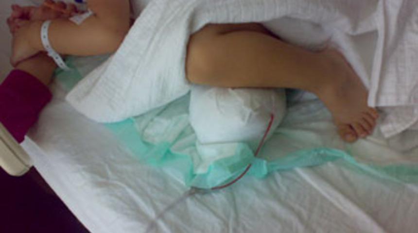 Sevdanur'un bacağı ihmal kurbanı mı?