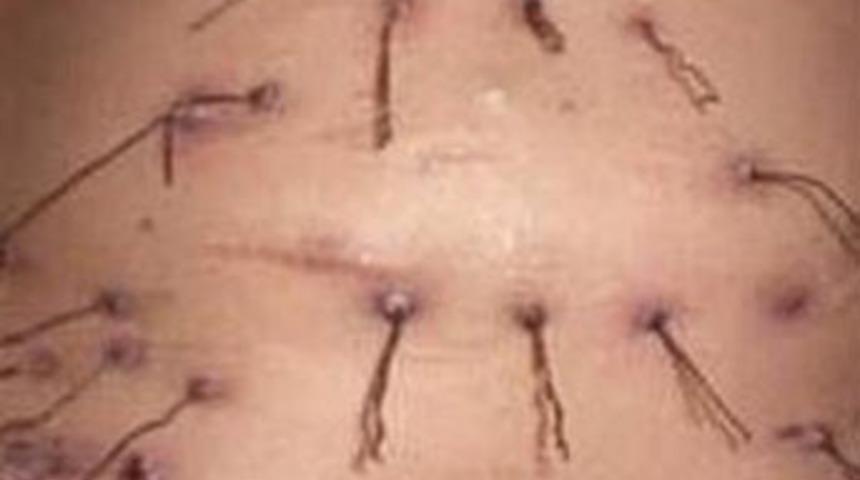 Bu garip hastalığa inanamayacaksınız!