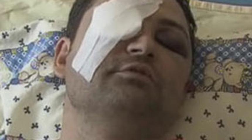 Şehir eşkıyaları TRT &ccedil;alışanını g&ouml;z&uuml;nden etti