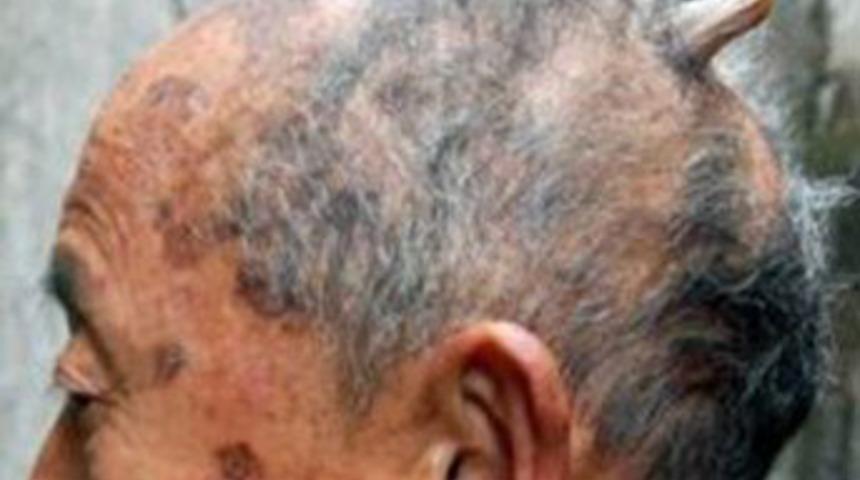 Bilim dünyası çaresiz