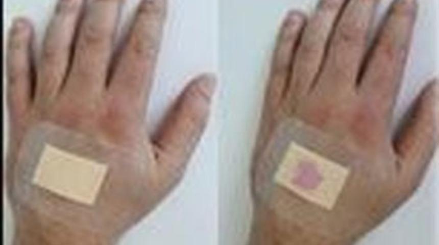 Akıllı yara bandı