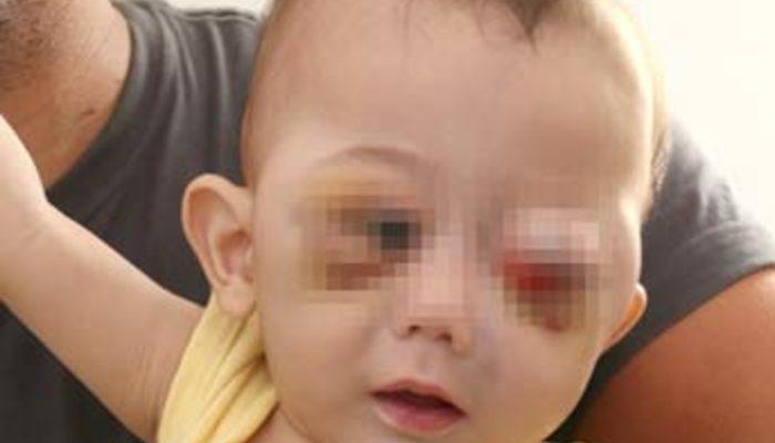 6 5 aylik bebegi annesi mi dovdu yasam haberleri