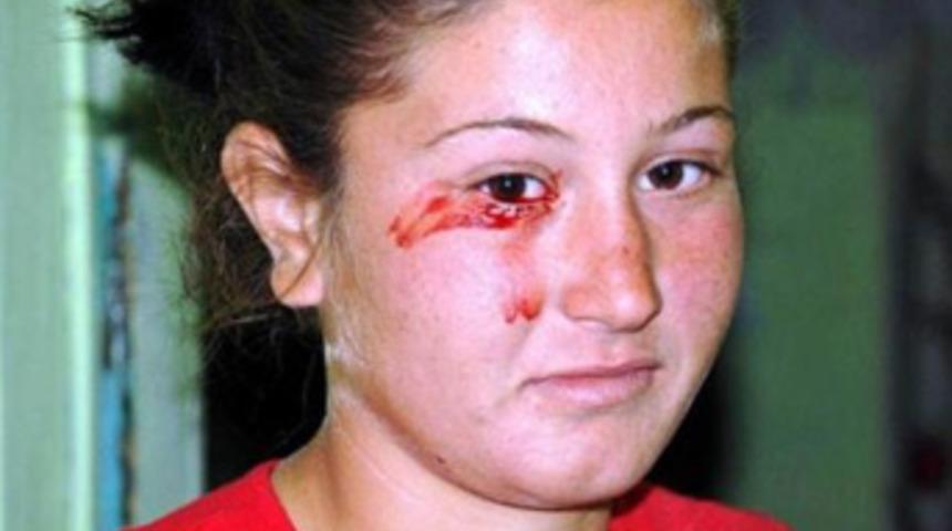 16 yaşındaki kız 'kan ağlıyor'