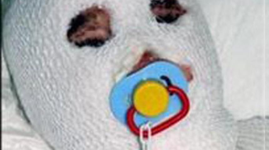 &Uuml;zerine kaynar &ccedil;aydanlık devrildi