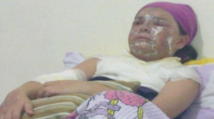 Tencere bomba gibi patladı