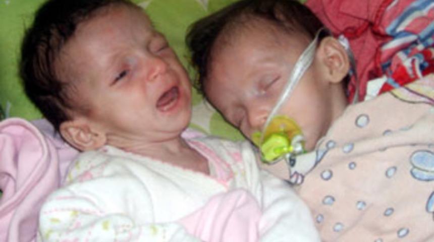 3.5 aylık ikizler beşiklerinde &ouml;l&uuml; bulundu