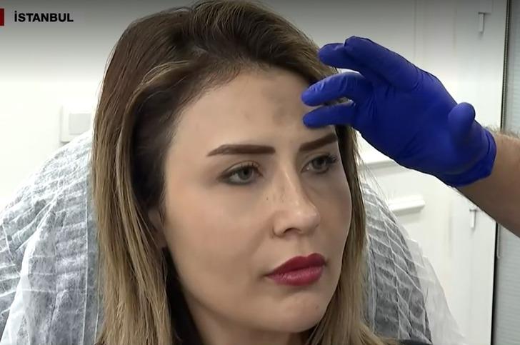 Yeni tehlikenin adı: İran botoksu! Ucuz olduğu için tercih ediliyor ama... Uzmanlar uyardı  G4