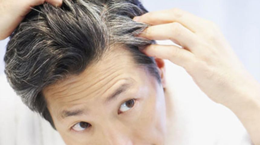 Beyaz Sa&ccedil;lara Son !!!