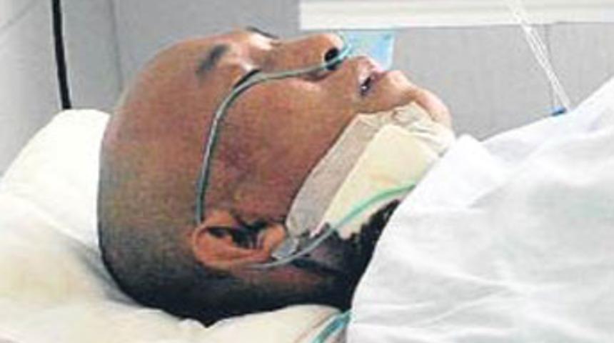 Kafasında 10 santimlik bı&ccedil;akla 4 yıl yaşadı