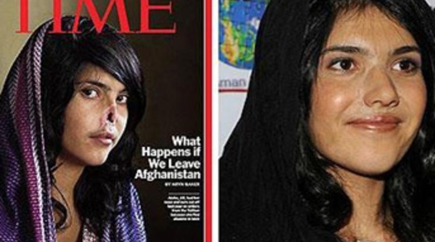 Yeni burnuyla kamera karşısında!