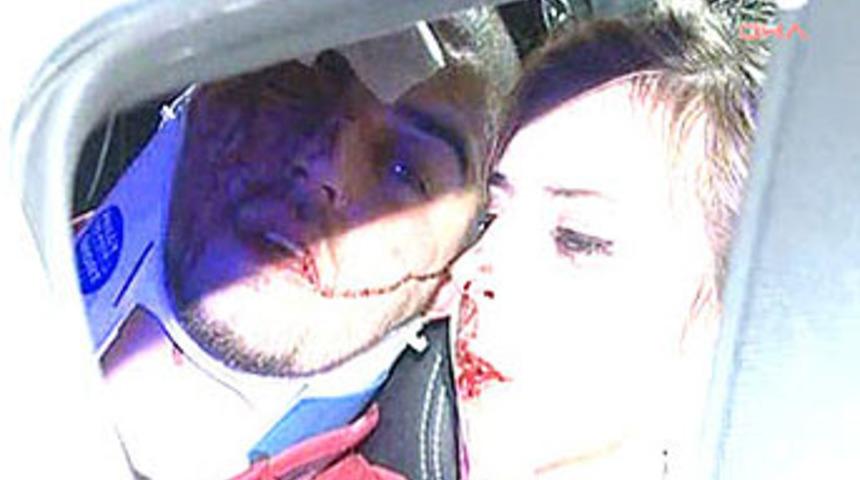 Aşkı acısını unutturdu