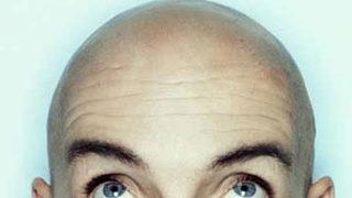 Erken yaşta kellik kanser habercisi mi?