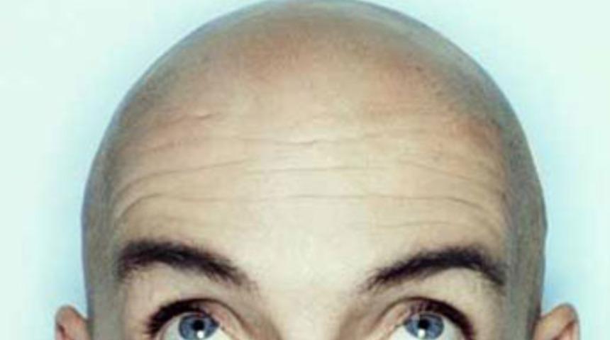 Erken yaşta kellik kanser habercisi mi?