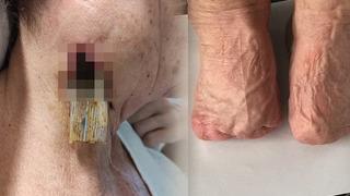 Doktorun verdiği ilacı içti, derisi çürüdü ve parmakları kesildi! 40'tan fazla ülke o ilacı yasakladı