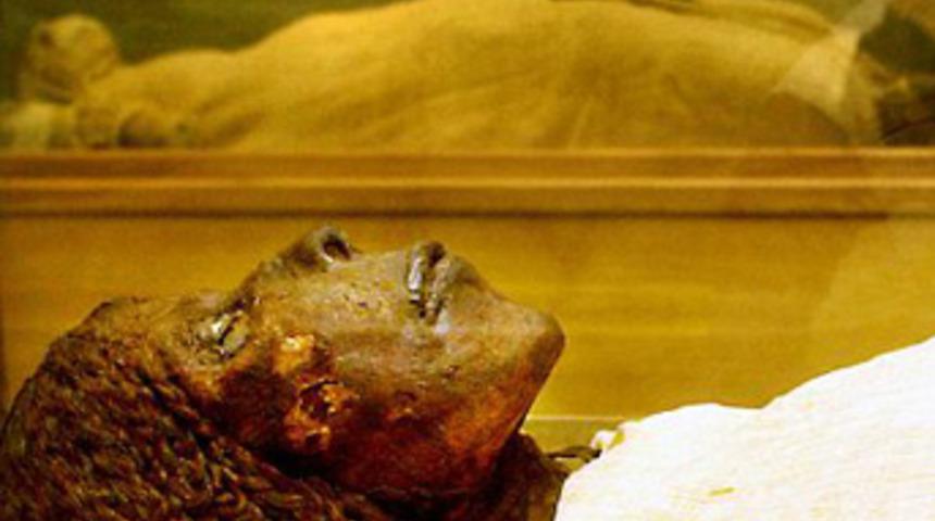 Kanserle ilgili şok ger&ccedil;ek!