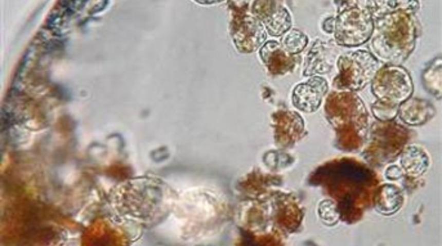 34 bin yaşında, hala hayatta!