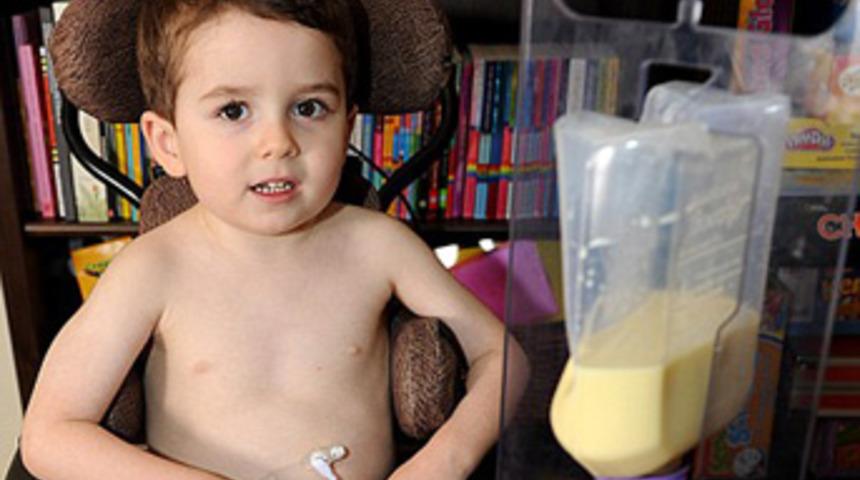 Bu &ccedil;ocuk 4 yıldır yemek yemiyor