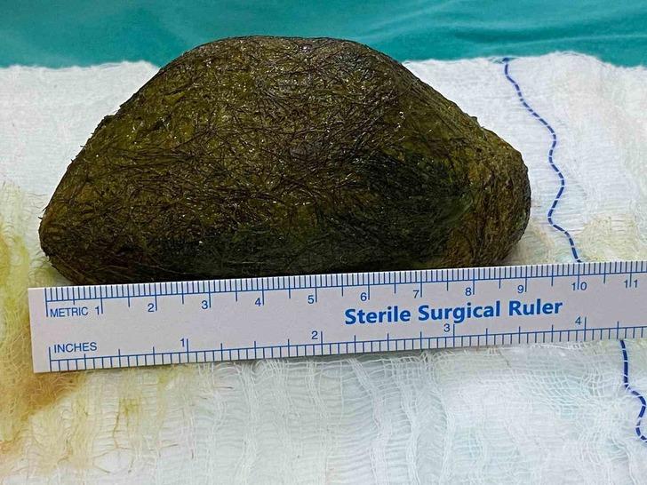 "ÇOĞUNLUKLA GEÇ FARK EDİLİRLER"