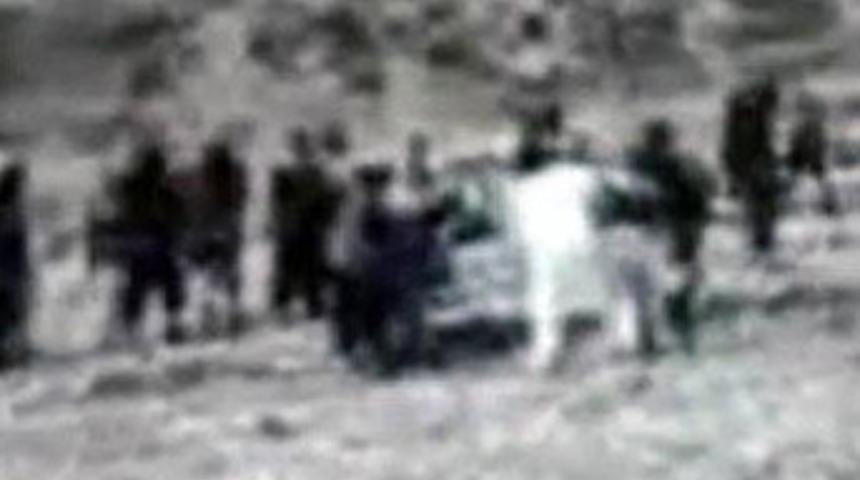 T&uuml;yler &uuml;rperten g&ouml;r&uuml;nt&uuml;ler