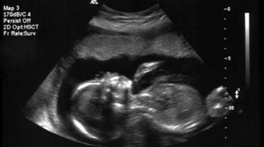 Teknoloji korkusu ana karnında başlıyor